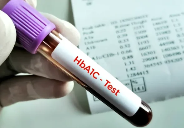 Hemoglobina glicată poate crește și din alte motive decât diabetul. Explicațiile medicilor