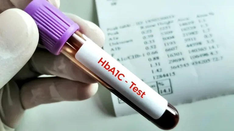Hemoglobina glicată poate crește și din alte motive decât diabetul. Explicațiile medicilor