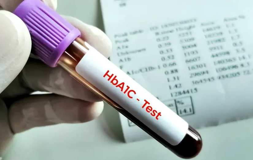 Hemoglobina glicată poate crește și din alte motive decât diabetul. Explicațiile medicilor